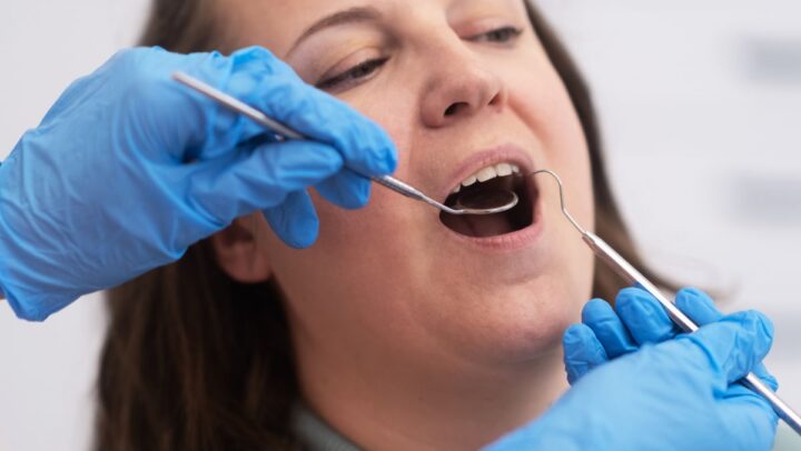Patient receiving a gentle dental checkup during a routine dental visit.