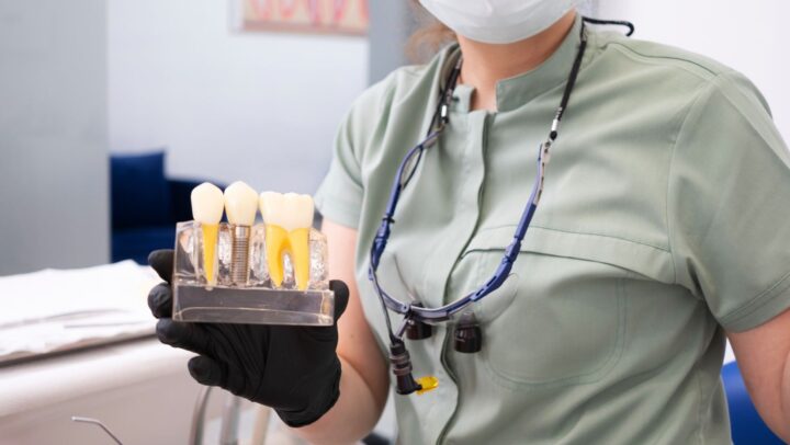 Dental professional displaying a dental implant model to demonstrate a durable tooth replacement solution.