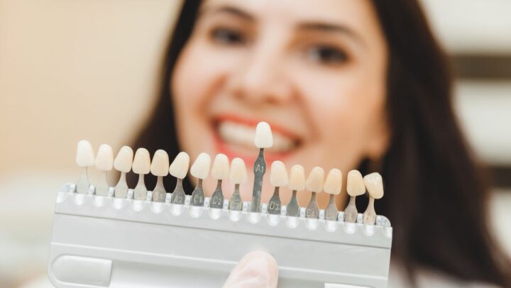 Dentist displaying a dental veneer shade guide to show how veneers match natural teeth and support a healthy smile.