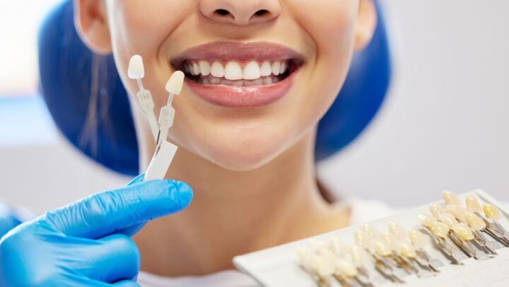 Patient selecting dental veneers for a brighter, more confident smile during a cosmetic dentistry consultation.
