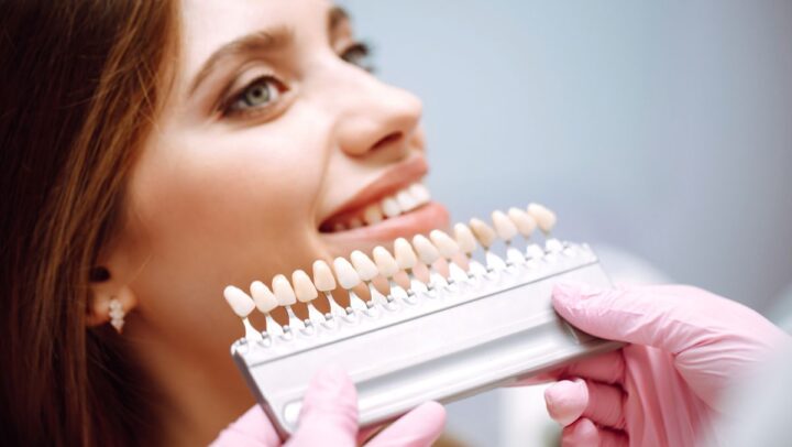 Adult patient selecting tooth shade with dentist for cosmetic veneers treatment.